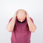 Best Foods to Prevent Baldness Naturally